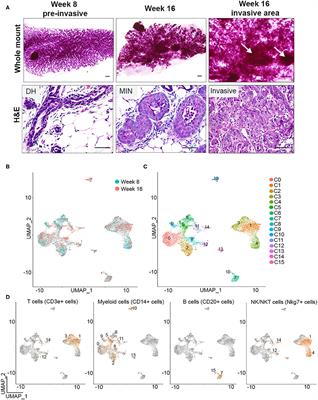 Diverse Macrophage Populations Contribute to the Inflammatory Microenvironment in Premalignant Lesions During Localized Invasion